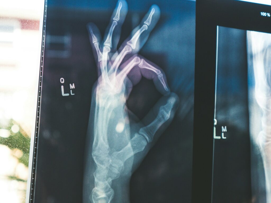 Google mở nguồn các mô hình AI MedGemma & MedSiglip: một bước ngoặt cho chăm sóc sức khỏe?